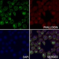 MKK1 Rabbit Polyclonal Antibody