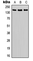 ASK1 (Phospho-S966) Rabbit Polyclonal Antibody