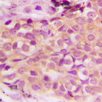 ASK1 (Phospho-S966) Rabbit Polyclonal Antibody