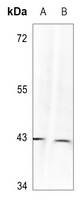 p38 (Phospho-Y323) Rabbit Polyclonal Antibody