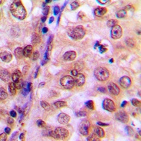 p38 (Phospho-Y323) Rabbit Polyclonal Antibody