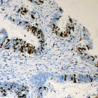 TRAP220 (Phospho-T1457) Rabbit Polyclonal Antibody