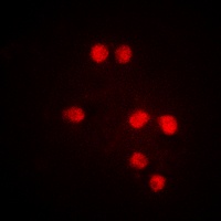 TRAP220 (Phospho-T1457) Rabbit Polyclonal Antibody