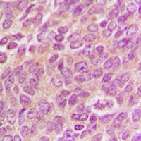 MFN2 Rabbit Polyclonal Antibody