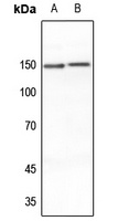 MEKKK6 Rabbit Polyclonal Antibody