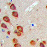 MEKKK6 Rabbit Polyclonal Antibody