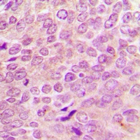 Merlin Rabbit Polyclonal Antibody