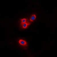 Merlin Rabbit Polyclonal Antibody