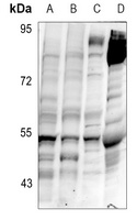Delta Opioid Receptor (Phospho-S363) Rabbit Polyclonal Antibody