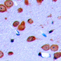 Delta Opioid Receptor (Phospho-S363) Rabbit Polyclonal Antibody