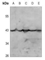 Kappa Opioid Receptor (Phospho-S369) Rabbit Polyclonal Antibody