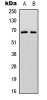 PAK1/2/3 (Phospho-S144/141/139) Rabbit Polyclonal Antibody