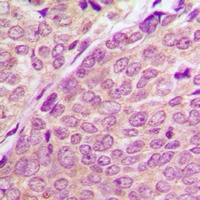 PAK1/2/3 (Phospho-S144/141/139) Rabbit Polyclonal Antibody