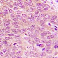 TOPK (Phospho-T9) Rabbit Polyclonal Antibody