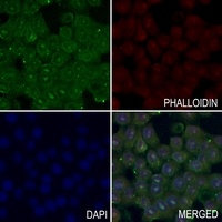 TOPK (Phospho-T9) Rabbit Polyclonal Antibody