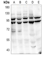 PI3K p85 alpha/p55 gamma (Phospho-Y467/199) Rabbit Polyclonal Antibody