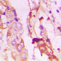PI3K p85 alpha/p55 gamma (Phospho-Y467/199) Rabbit Polyclonal Antibody