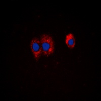 PI3K p85 alpha/p55 gamma (Phospho-Y467/199) Rabbit Polyclonal Antibody