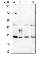 DARPP32 (Phospho-T34) Rabbit Polyclonal Antibody
