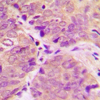 DARPP32 (Phospho-T34) Rabbit Polyclonal Antibody