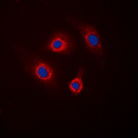 DARPP32 (Phospho-T34) Rabbit Polyclonal Antibody