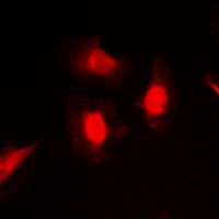 PKC iota/zeta (Phospho-T412/410) Rabbit Polyclonal Antibody