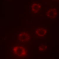 PTX3 Rabbit Polyclonal Antibody