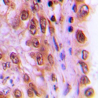 c-Rel (Phospho-S503) Rabbit Polyclonal Antibody