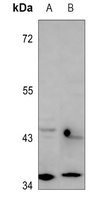 RagA/B Rabbit Polyclonal Antibody