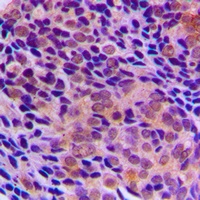 RagA/B Rabbit Polyclonal Antibody