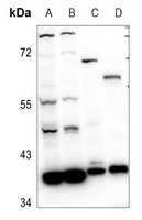 RRM2B Rabbit Polyclonal Antibody