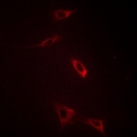 Ryanodine Receptor 2 Rabbit Polyclonal Antibody