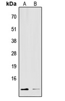 S100-A16 Rabbit Polyclonal Antibody