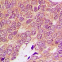 S100-A16 Rabbit Polyclonal Antibody