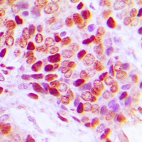 SF1 (Phospho-S82) Rabbit Polyclonal Antibody