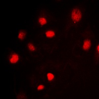 SF1 (Phospho-S82) Rabbit Polyclonal Antibody