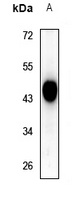 SIRT3 Rabbit Polyclonal Antibody