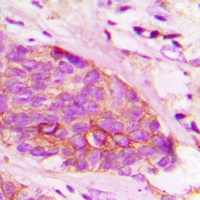 Alpha-synuclein Rabbit Polyclonal Antibody