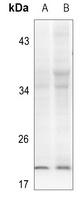 Alpha-synuclein (Phospho-Y133) Rabbit Polyclonal Antibody