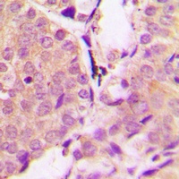 Alpha-synuclein (Phospho-Y133) Rabbit Polyclonal Antibody