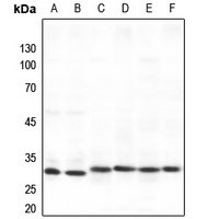 SPIN1 Rabbit Polyclonal Antibody