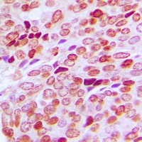SPIN1 Rabbit Polyclonal Antibody