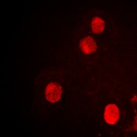 SPIN1 Rabbit Polyclonal Antibody