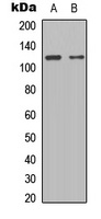 STAT2 Rabbit Polyclonal Antibody