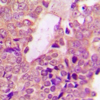 STAT2 Rabbit Polyclonal Antibody