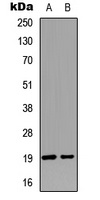 STMN1 (Phospho-S25) Rabbit Polyclonal Antibody