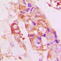 STMN1 (Phospho-S25) Rabbit Polyclonal Antibody