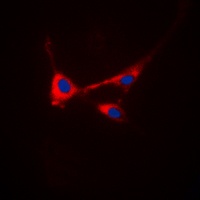 STMN1 (Phospho-S25) Rabbit Polyclonal Antibody