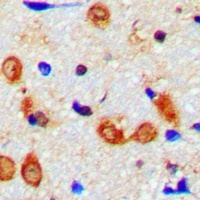 Synaptotagmin Rabbit Polyclonal Antibody