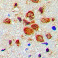 Tyrosine Hydroxylase (Phospho-S19) Rabbit Polyclonal Antibody